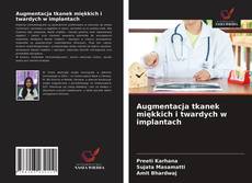 Buchcover von Augmentacja tkanek miękkich i twardych w implantach