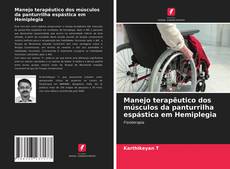 Bookcover of Manejo terapêutico dos músculos da panturrilha espástica em Hemiplegia