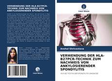 Capa do livro de VERWENDUNG DER HLA-B27PCR-TECHNIK ZUM NACHWEIS VON ANKYLOSIERENDER SPONDYLITIS 