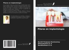 Bookcover of Pilares en implantología