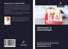 Обложка Abutments in implantologie