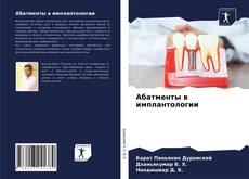 Bookcover of Абатменты в имплантологии