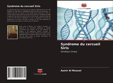 Buchcover von Syndrome du cercueil Siris