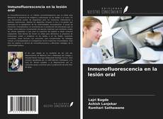 Borítókép a  Inmunofluorescencia en la lesión oral - hoz