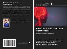 Bookcover of Aneurismas de la arteria intracraneal
