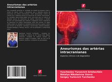 Aneurismas das artérias intracranianas的封面