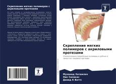 Bookcover of Скрепление мягких полимеров с акриловыми протезами