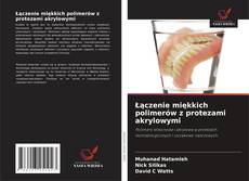 Buchcover von Łączenie miękkich polimerów z protezami akrylowymi