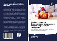 Bookcover of Эффективность биомаркеров сердца при остром коронарном синдроме