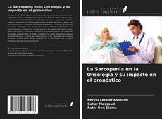 Buchcover von La Sarcopenia en la Oncología y su impacto en el pronóstico