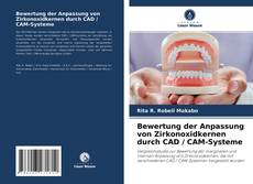 Bewertung der Anpassung von Zirkonoxidkernen durch CAD / CAM-Systeme kitap kapağı