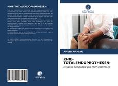 Couverture de KNIE-TOTALENDOPROTHESEN: