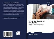 Borítókép a  ПОЛНАЯ ЗАМЕНА КОЛЕНА: - hoz