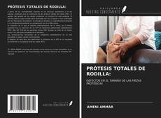 Обложка PRÓTESIS TOTALES DE RODILLA: