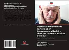 Borítókép a  Dysfonctionnement de l'articulation temporomandibulaire chez les patients atteints de lupus - hoz