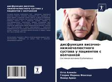 Portada del libro de дисфункция височно-нижнечелюстного сустава у пациентов с волчанкой