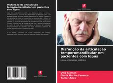 Disfunção da articulação temporomandibular em pacientes com lúpus的封面
