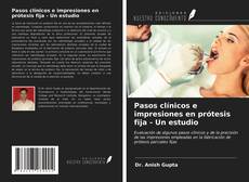 Bookcover of Pasos clínicos e impresiones en prótesis fija - Un estudio