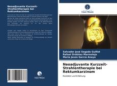 Couverture de Neoadjuvante Kurzzeit-Strahlentherapie bei Rektumkarzinom