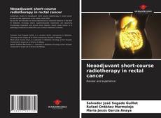 Couverture de Neoadjuvant short-course radiotherapy in rectal cancer