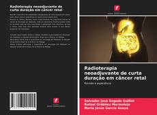 Capa do livro de Radioterapia neoadjuvante de curta duração em câncer retal 