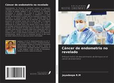 Bookcover of Cáncer de endometrio no revelado