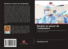 Révéler le cancer de l'endomètre kitap kapağı