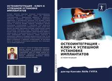 Bookcover of ОСТЕОИНТЕГРАЦИЯ - КЛЮЧ К УСПЕШНОЙ УСТАНОВКЕ ИМПЛАНТАТОВ