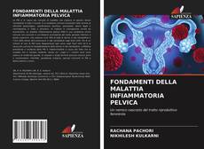 FONDAMENTI DELLA MALATTIA INFIAMMATORIA PELVICA的封面