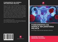 FUNDAMENTOS DA DOENÇA INFLAMATÓRIA PÉLVICA的封面