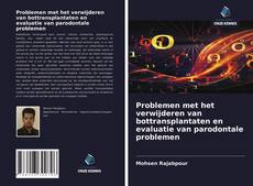 Buchcover von Problemen met het verwijderen van bottransplantaten en evaluatie van parodontale problemen