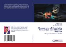 Buchcover von Management of Completely Edentulous Mandible with Implants