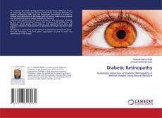 Copertina di Diabetic Retinopathy