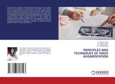 Copertina di PRINCIPLES AND TECHNIQUES OF SINUS AUGMENTATION