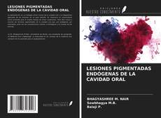 Capa do livro de LESIONES PIGMENTADAS ENDÓGENAS DE LA CAVIDAD ORAL 