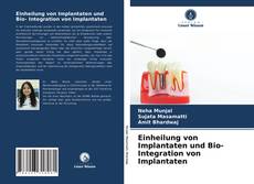 Couverture de Einheilung von Implantaten und Bio- Integration von Implantaten