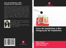 Обложка Cura de Implantes e Bio- Integração de Implantes