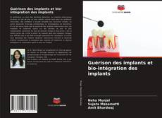 Copertina di Guérison des implants et bio-intégration des implants