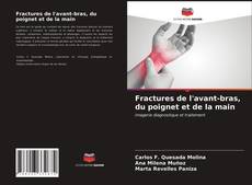 Copertina di Fractures de l'avant-bras, du poignet et de la main