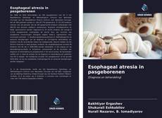 Bookcover of Esophageal atresia in pasgeborenen