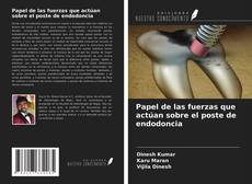 Portada del libro de Papel de las fuerzas que actúan sobre el poste de endodoncia