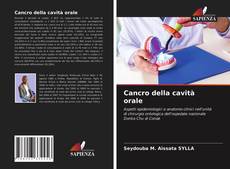 Buchcover von Cancro della cavità orale