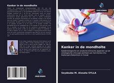 Bookcover of Kanker in de mondholte