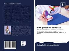 Bookcover of Рак ротовой полости