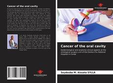 Bookcover of Cancer of the oral cavity