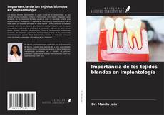 Buchcover von Importancia de los tejidos blandos en implantología