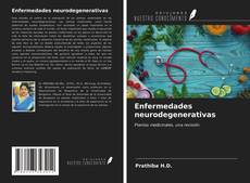 Couverture de Enfermedades neurodegenerativas