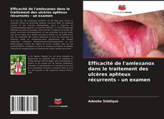 Copertina di Efficacité de l'amlexanox dans le traitement des ulcères aphteux récurrents - un examen