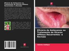 Portada del libro de Eficácia da Amlexanox no Tratamento de Úlceras Afthous Recorrentes -a Revisão