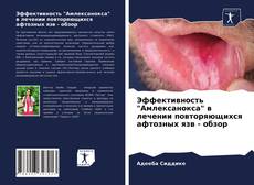 Portada del libro de Эффективность "Амлексанокса" в лечении повторяющихся афтозных язв - обзор